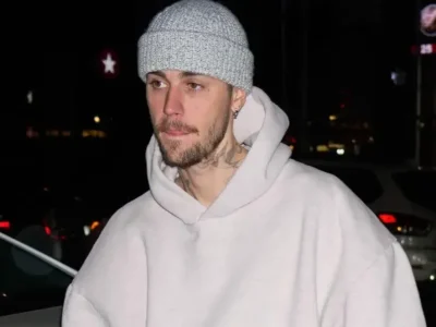 Penampilan Justin Bieber mengkhawatirkan fans (Foto: GC Images)