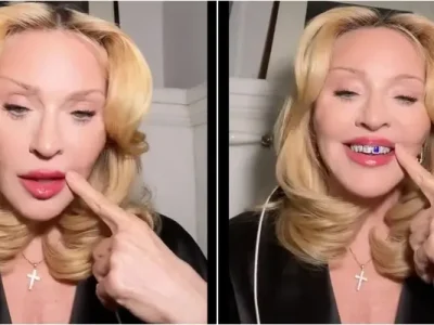 Madonna saat memamerkan grillz alias aksesoris gigi (Foto: TikTok/madonna)