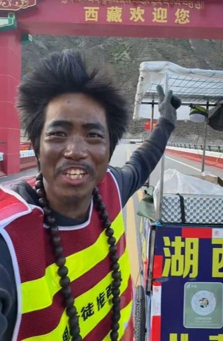 Wajah yang berubah menjadi seperti usia 50-an. Foto: Dok. 163.com