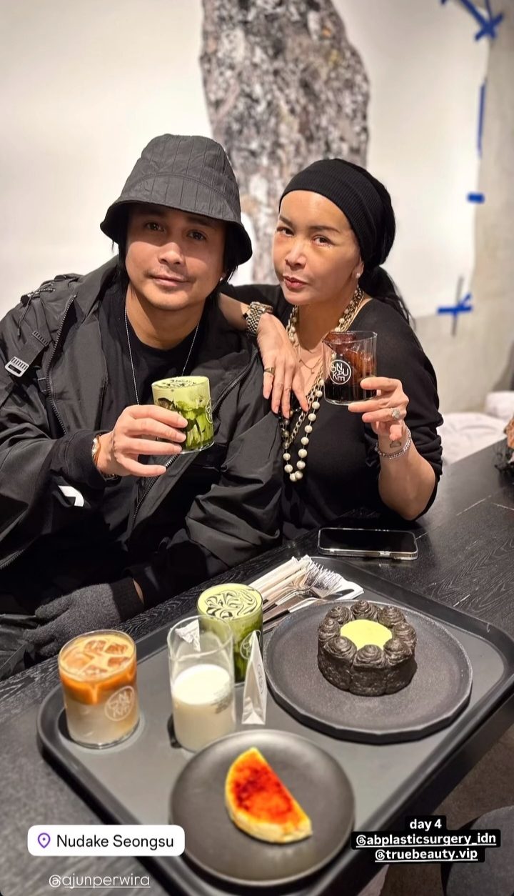 Setelah oplas (Foto: Instagram/ajunperwira)