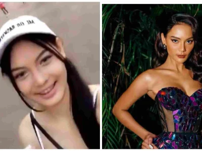 Perbedaan Erika Carlina sebelum dan sesudah oplas. Foto : Instagram/Eri.carl
