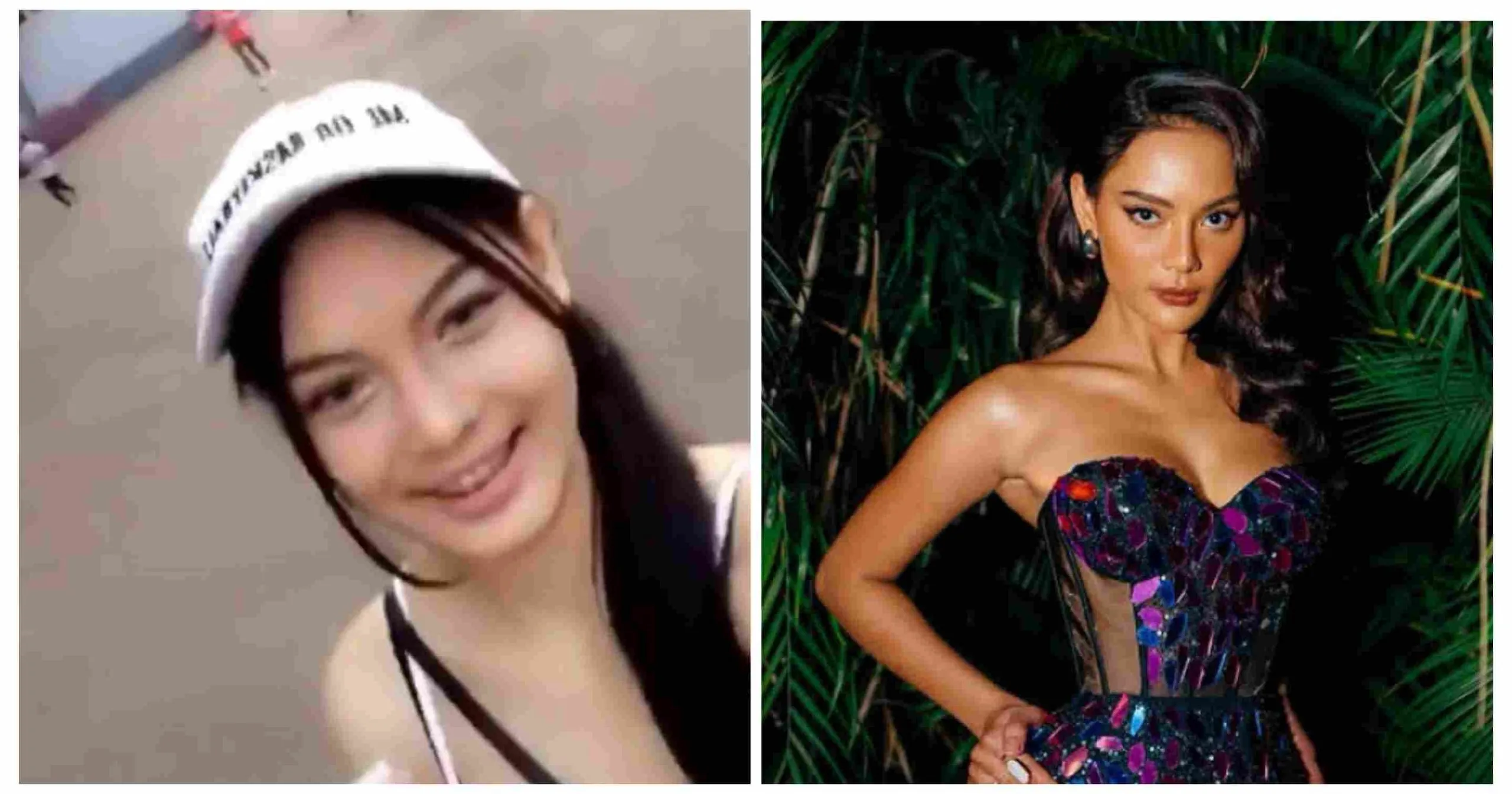 Erika Carlina Jalani Operasi Hidung dan Mulut, Begini Perubahannya
