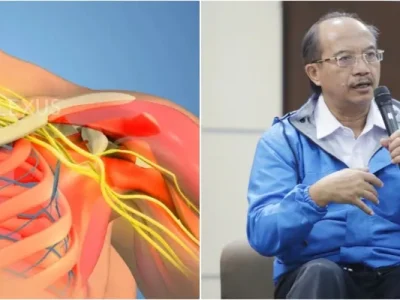 Dr. Heri jelaskan apa itu brachial plexus (Ilustrasi: Dok. Plexus Bangalore, Foto: Nyata/Ikhsan)