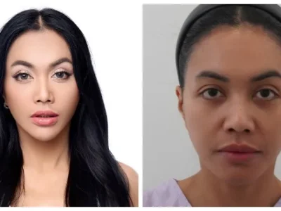 MAKIN CANTIK: Hasil oplas yang dijalani Denada. Foto : Instagram/denadaindonesia