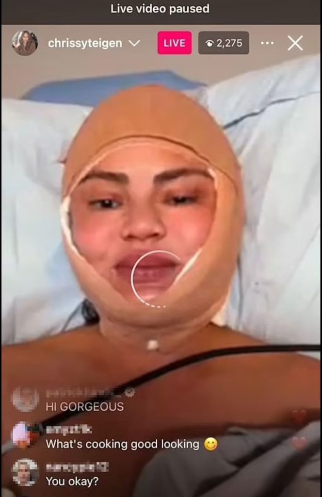 Sesi live Instagram yang membuat netizen khawatir (Foto: Instagram/chrissyteigen)