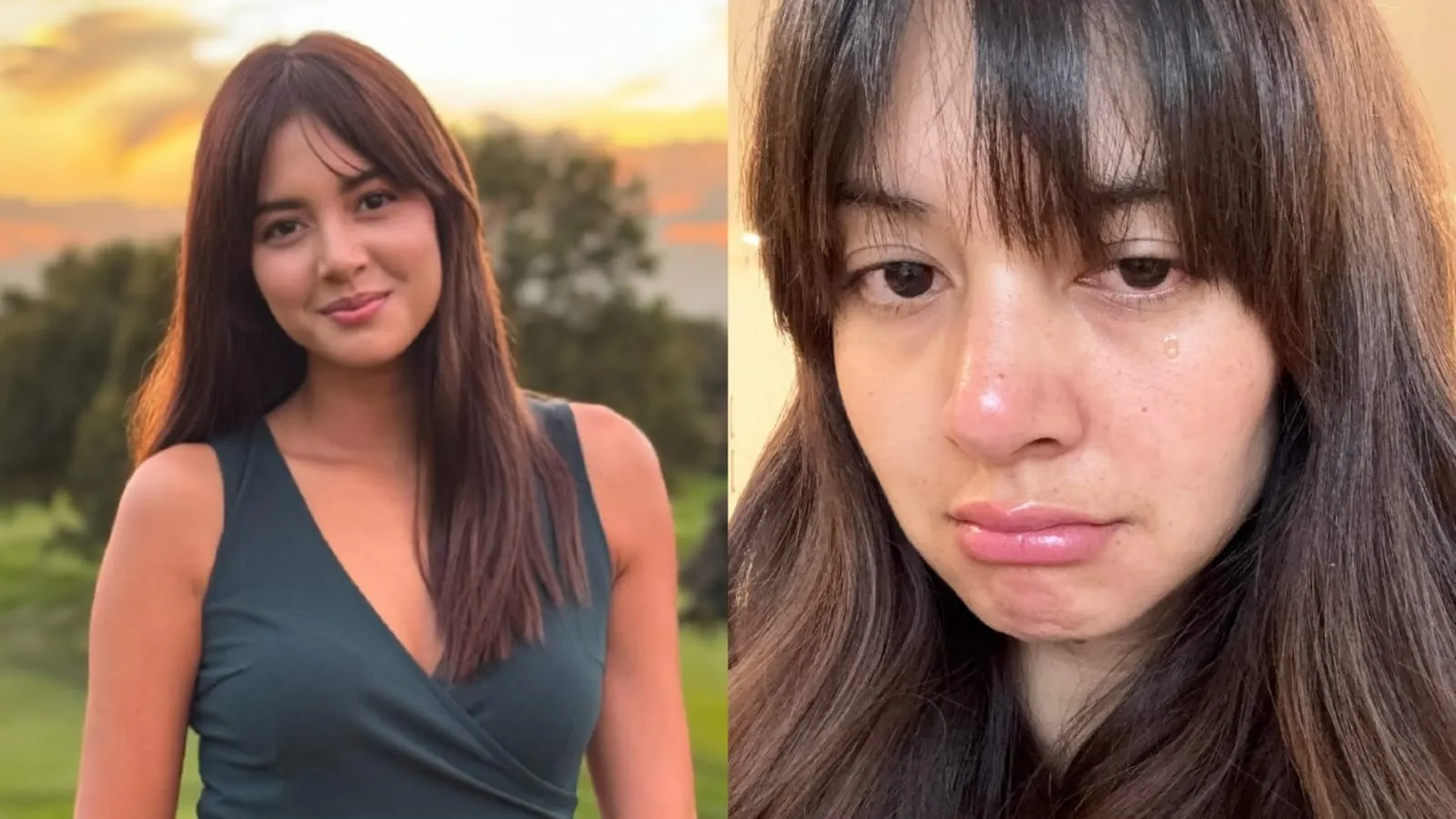 Curhat Pilu Aurelie Moeremans, Dua Bagian Otak Menyusut Karena Kecelakaan