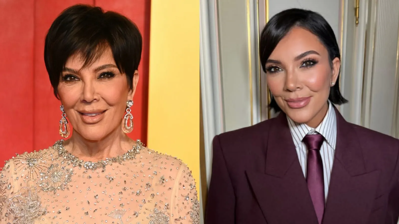 Keriput Hilang, Before-After Wajah Kris Jenner yang Makin Muda