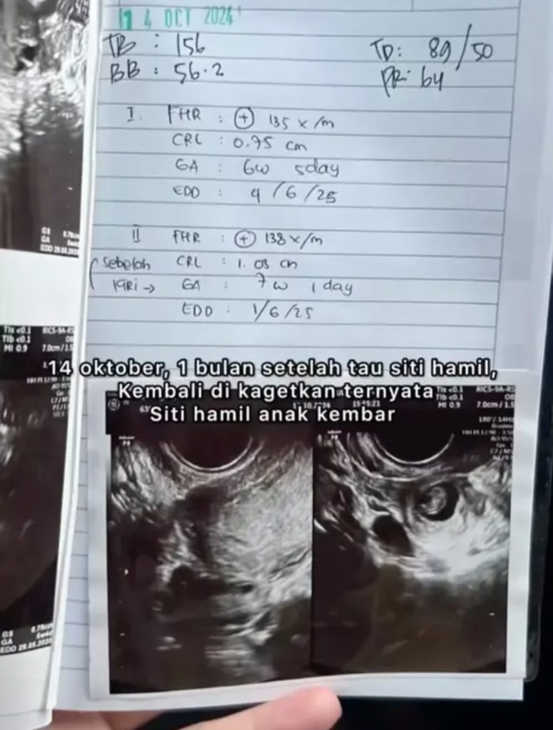 Krisjiana memberi pengumuman sedih terkait calon anaknya (Foto: Instagram/krisjianabah)