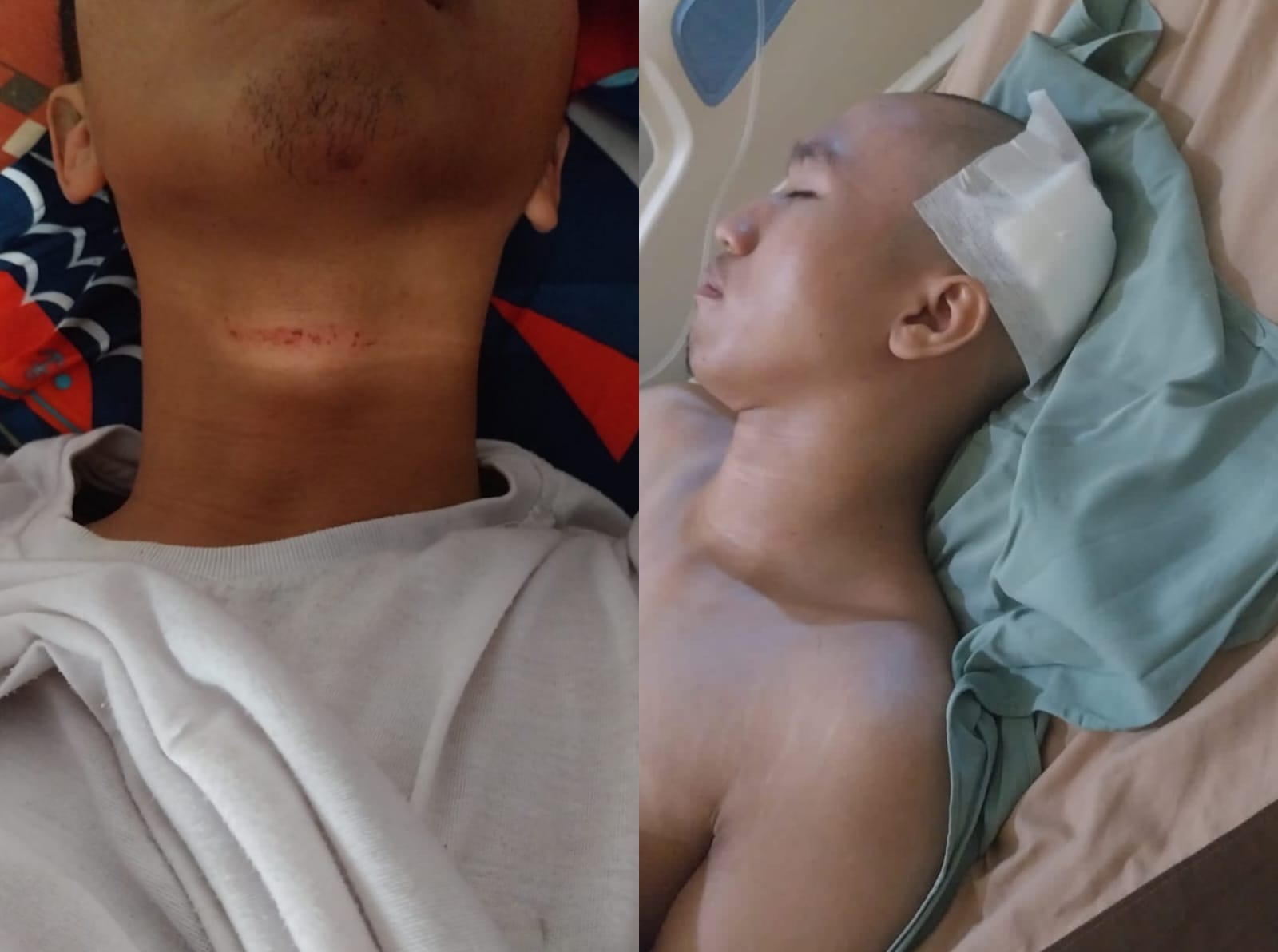 Luka-luka di tubuh Odo. Foto: Dok. Nyata