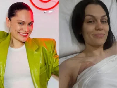 Jessie J menjalani operasi kanker payudara. Foto: Dok. Instagram @jessiej