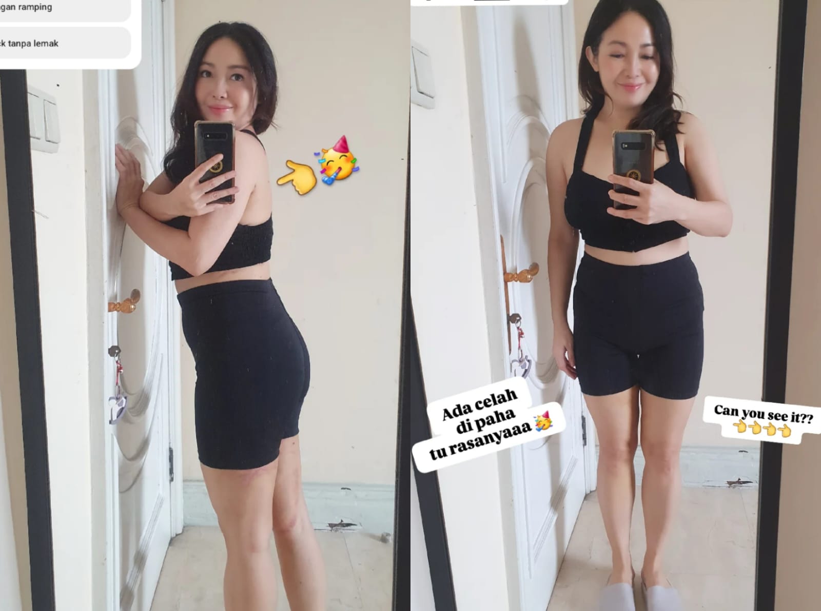 Rinrin Marinka setelah sedot lemak. Foto: Dok. Instagram @rinrinmarinka