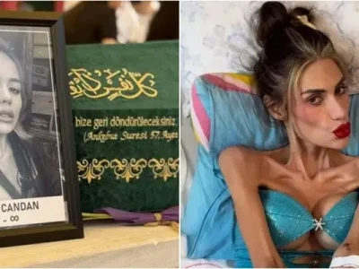 Nihal Candan meninggal karena anoreksia nervosa (Foto: X/Kandinn_Sesi)