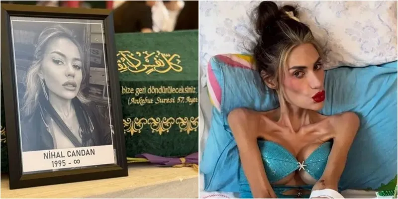 Influencer Turki, Nihal Candan Meninggal karena Anoreksia Nervosa