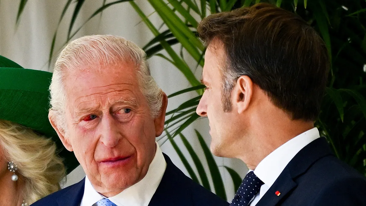 Mata Merah Raja Charles III Picu Kekhawatiran di Tengah Pengobatan Kanker
