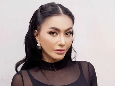 Hidung Denada terbentur tumbler hingga kaca mobil setelah oplas. Foto : Instagram/denadaindonesia