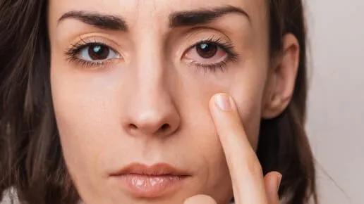 Anak Muda Waspada Retinopati Diabetik, Diabetes Bisa Berujung Kebutaan