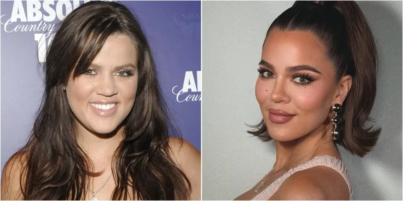 Khloe Kardashian Bongkar Oplas yang Pernah Dilakukan