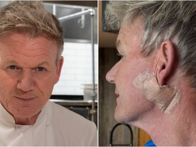 Gordon Ramsay operasi kanker kulit (Foto: Instagram/gordongram)