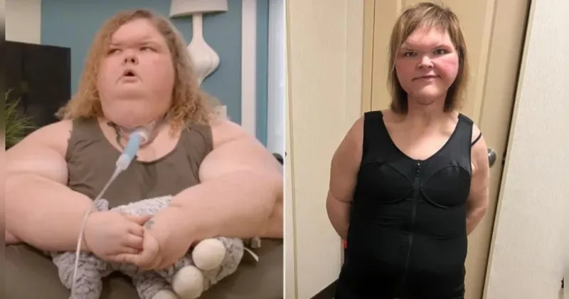 Kisah Tammy Slaton BB 328 Kg, Takut Lakukan Operasi Pemotongan Kulit