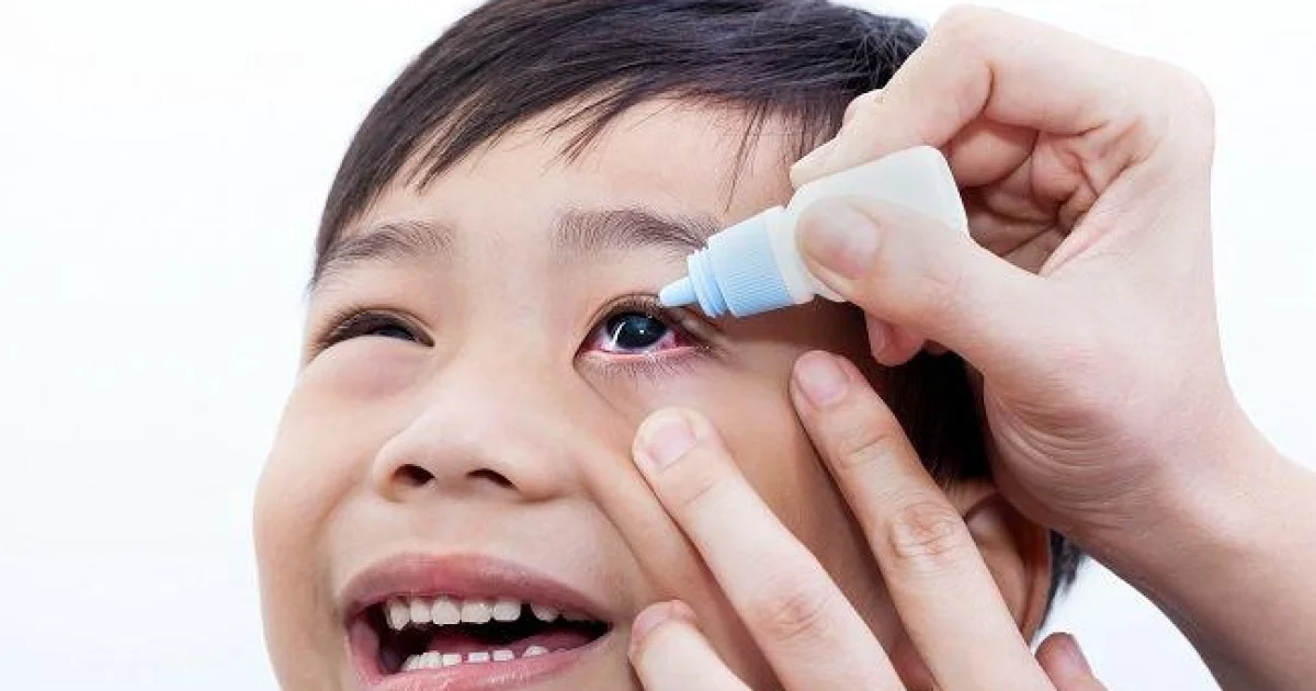 Mata Merah Bukan Cuma Kurang Tidur, Kenali Uveitis yang Bisa Bikin Buta
