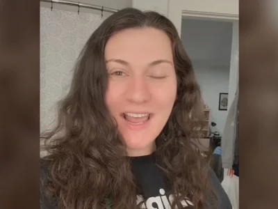 Kelopak mata kiri Lydia August menutup sendiri karena botox migrain (Foto: TikTok/lydiaaugust)