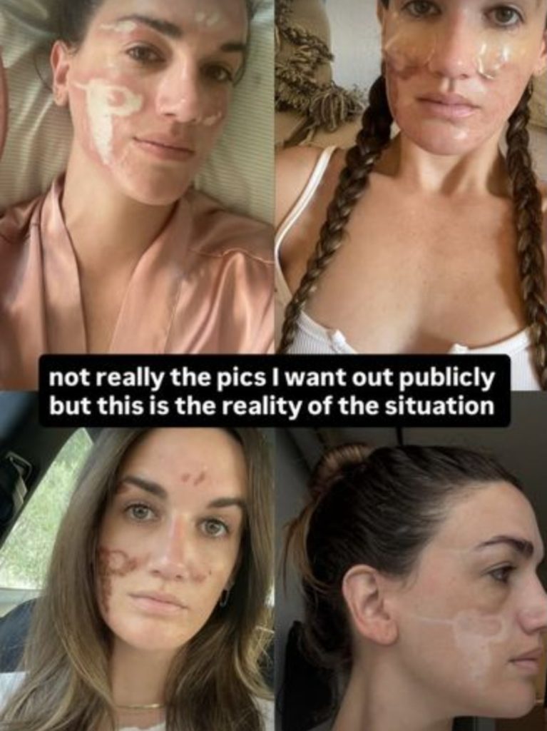  TikTok/Victoria Nelson)