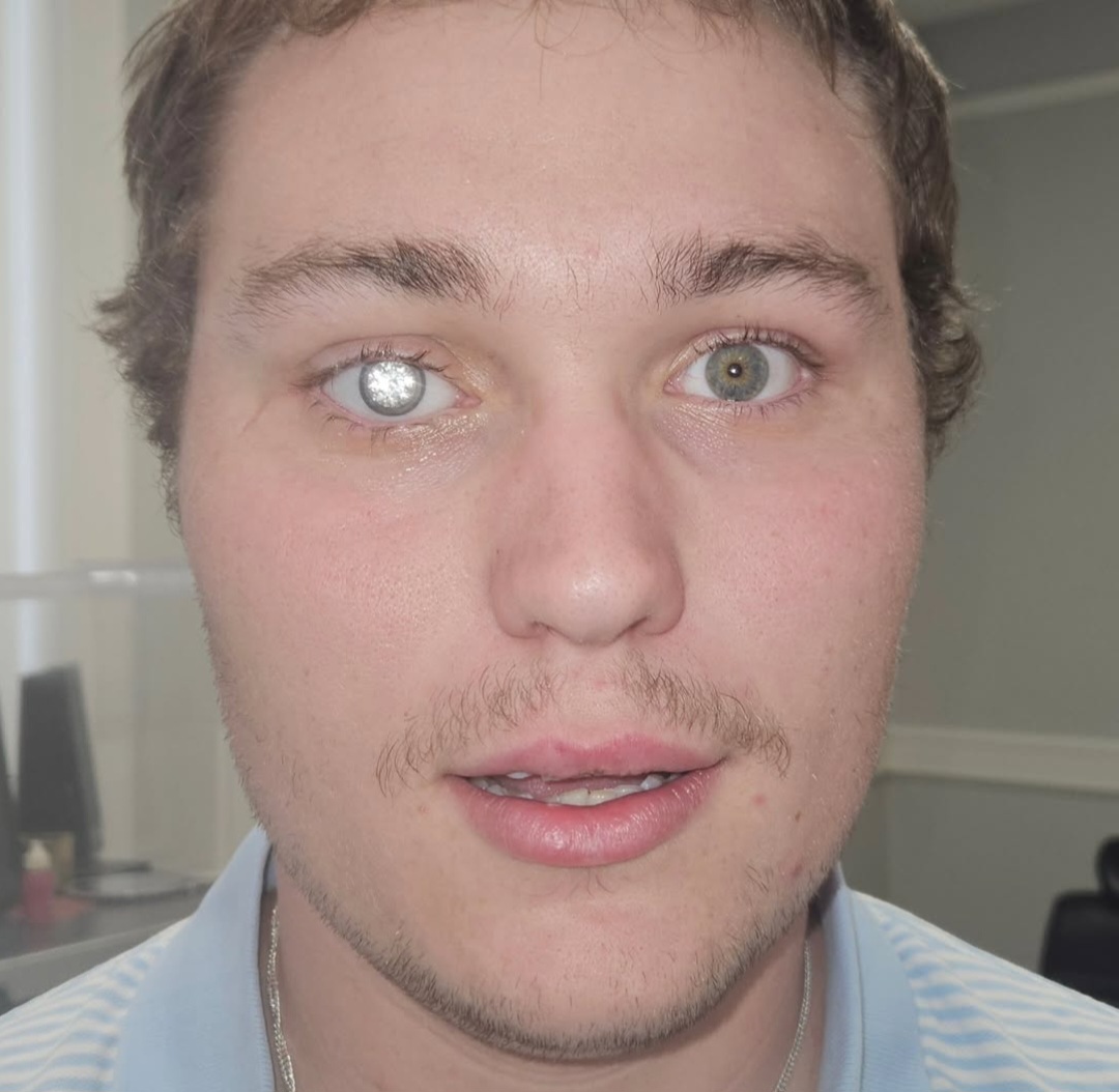 Mata palsu berhiaskan berlian 2 karat. Foto: Dok. Instagram @artificialeyesbyjohnimm