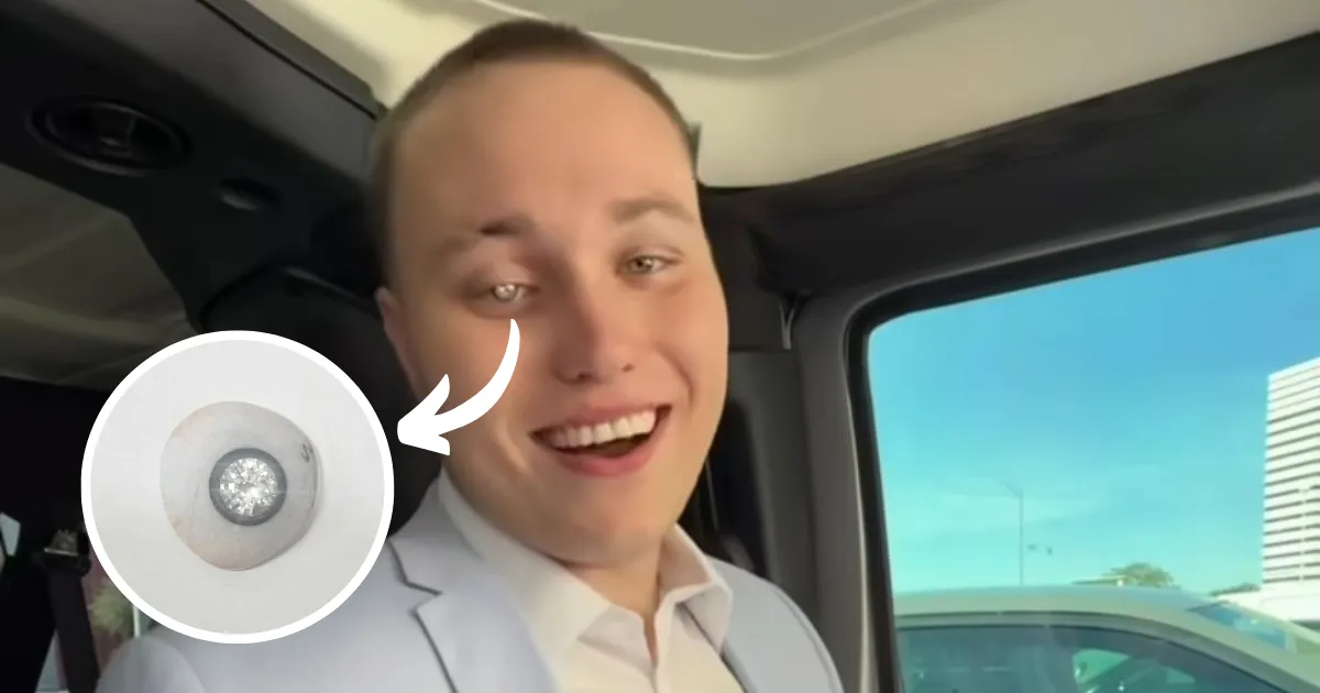 Slater Jones, Desainer Perhiasan AS Pasang Berlian 2 Karat di Mata Kanan