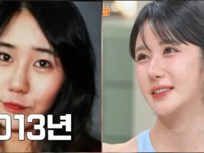 Gil Lee Won dulu dan sekarang, setelah operasi plastik (Foto: YouTube/tvN D ENT)
