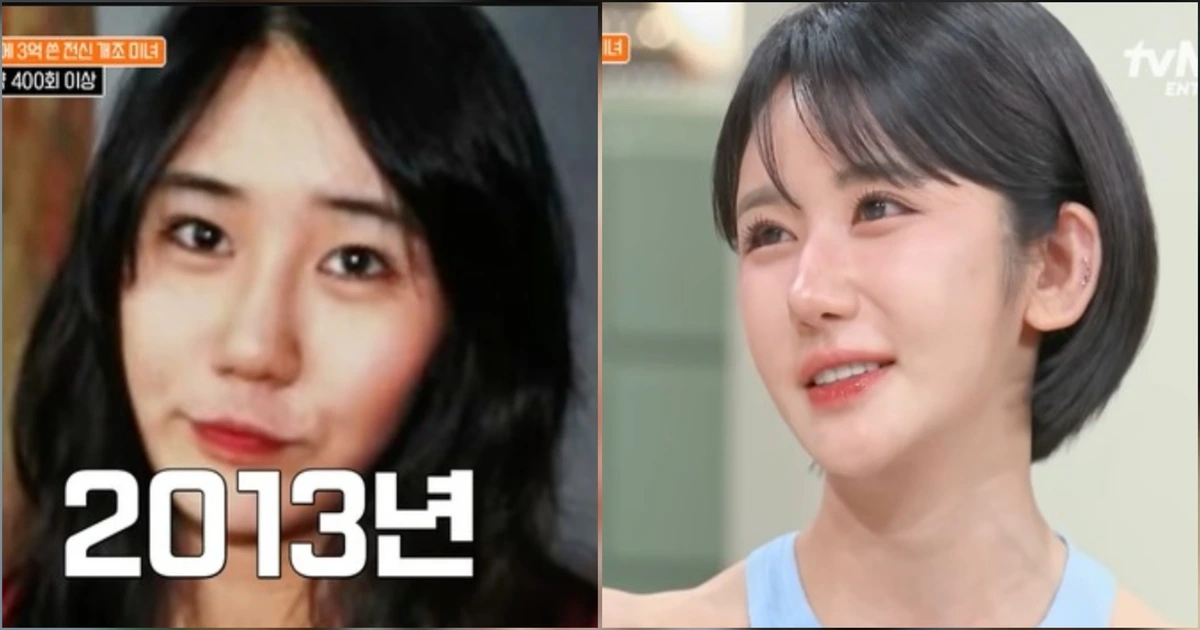 Wanita Korea Selatan ini Jalani Operasi Plastik 400 Kali usai Dikritik Pacar