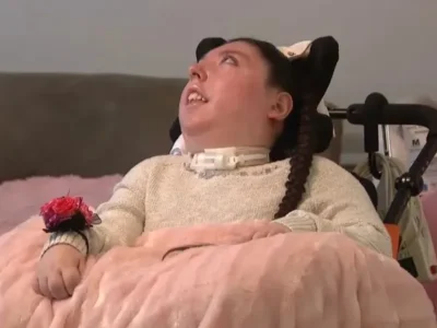 Alex Simpson, gadis yang mengidap hidranensefali. Foto: Dok. WHAS11/Youtube