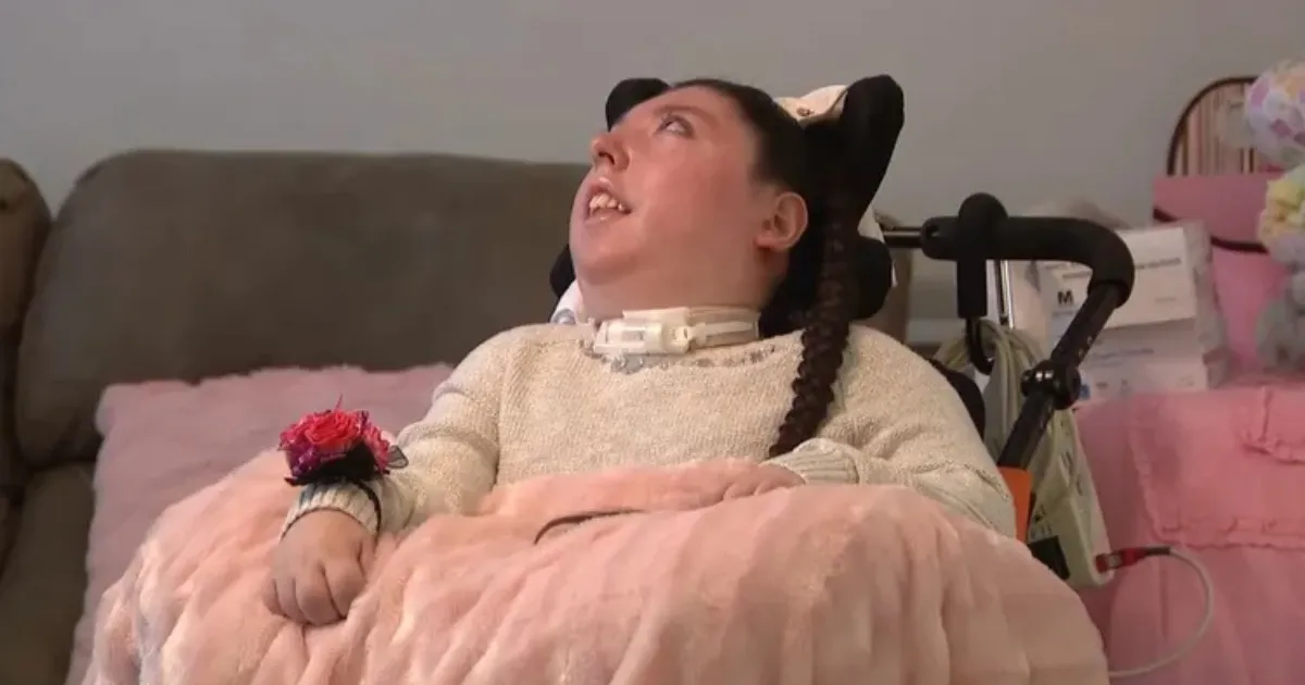 Keajaiban Tuhan, Alex Simpson Bertahan Hidup Meski Lahir Tanpa Otak