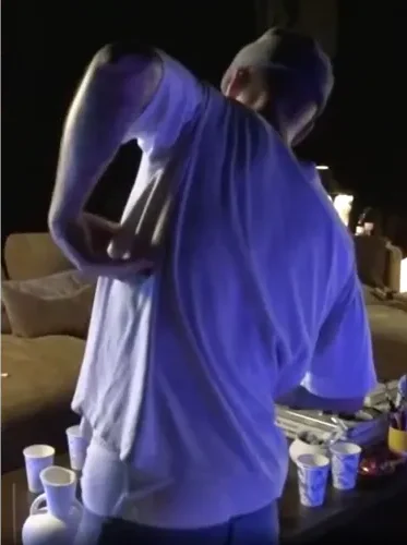 Justin Bieber kesakitan. Foto : Justin Bieber/Twitch