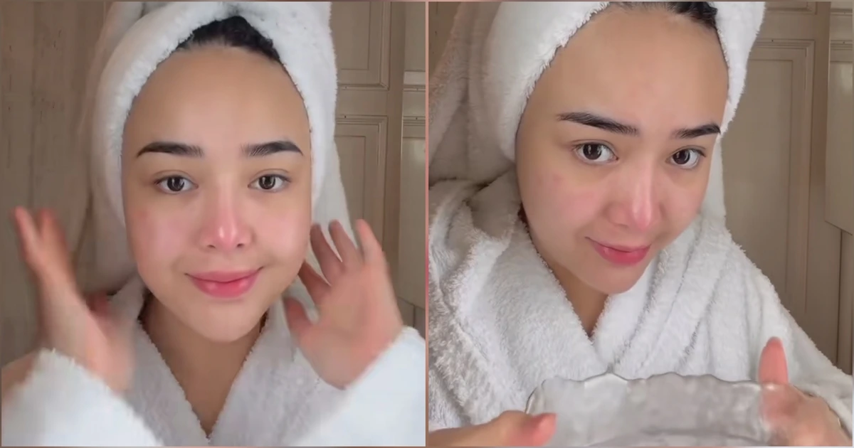 Dilakukan Amanda Manopo, Ini Manfaat Cuci Muka dengan Air Es