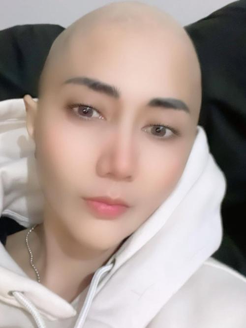 Saat kepala botak (Foto: Instagram/aidasaskia.new)